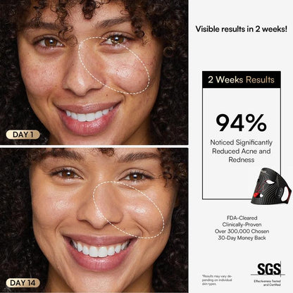 INIA GLOW Wireless LED Face Mask - Rechargeable Red Light Therapy for Radiant Skin, Perfect for Home or Travel, 2-Year Warranty, Ideal Gift for Any Occasion